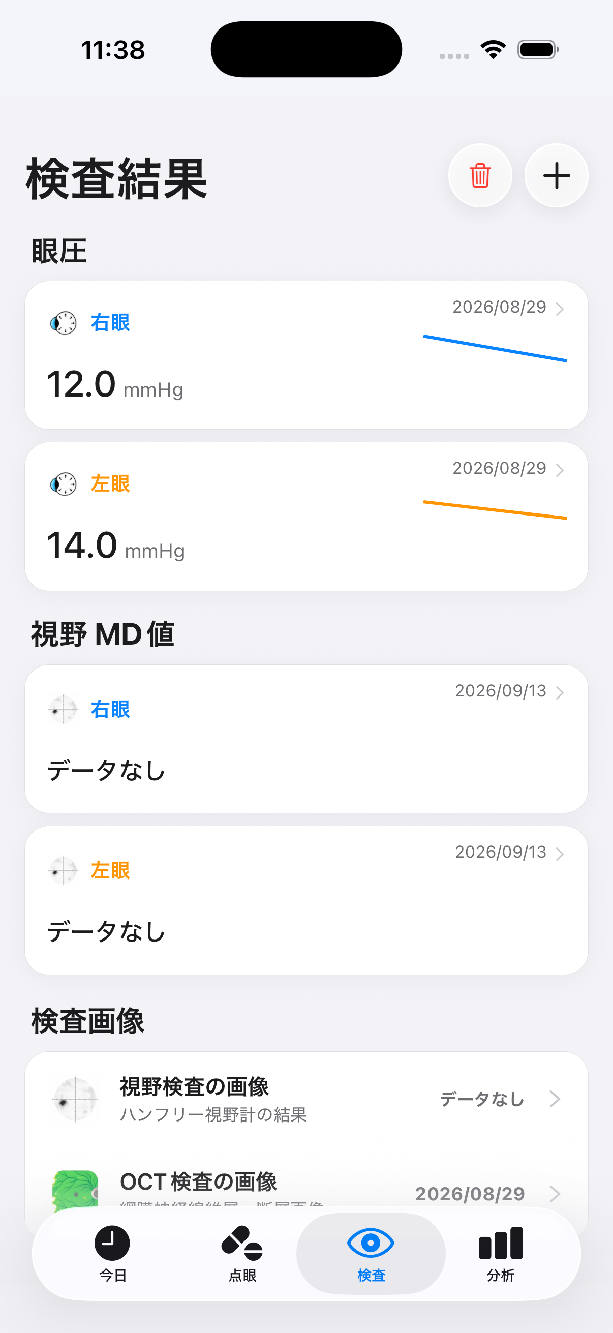 眼圧と視野検査の記録画面